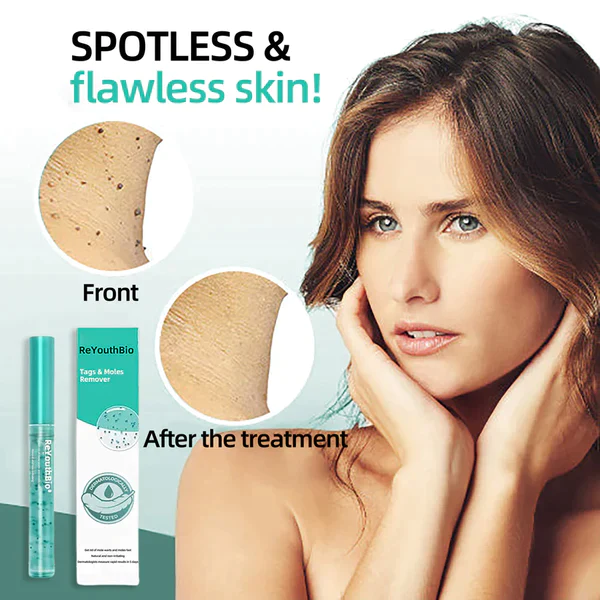 ReYouthBioŽ Tags & Moles Remover