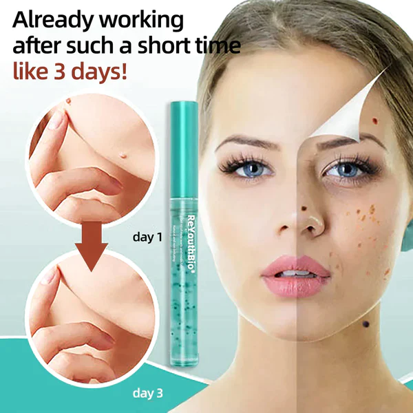 ReYouthBioŽ Tags & Moles Remover