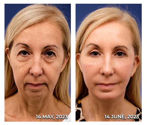 flysmus HERASKIN Australian Natural Pamper Cleansing Balm