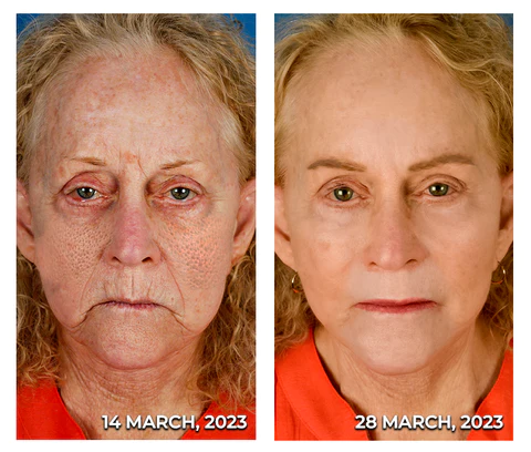 flysmus HERASKIN Australian Natural Pamper Cleansing Balm