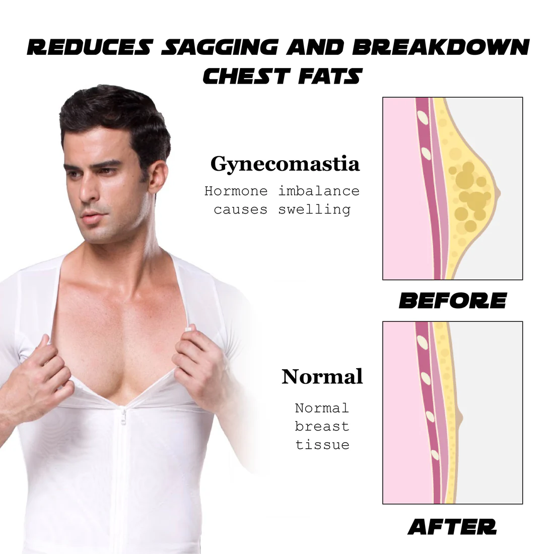 Ricpind MenGynecomastia Infrared Compression T-Shirt