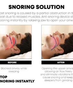 GFOUK Vibrating Pulse Snore Stopper