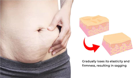 Oveallgo Avocado Ageless Body Cream Scrub