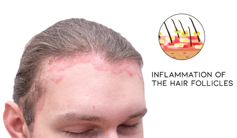 Fivfivgo Olive Hair Scalp Repair Spray