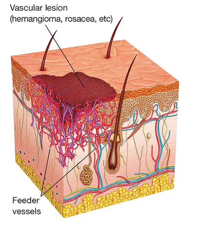 Oveallgo Clearasil Petechiae Removal Cream