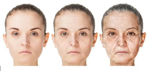 NewBornSkin MicroInfusion Needling System