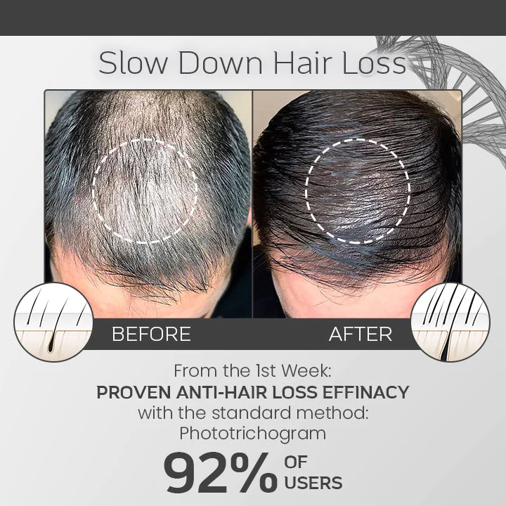 Ceoerty Hair Loss Defense Spray