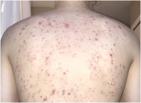 SkinDivision Almond Body Clearing Spray