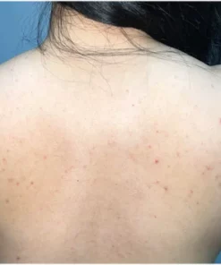 SkinDivision Almond Body Clearing Spray