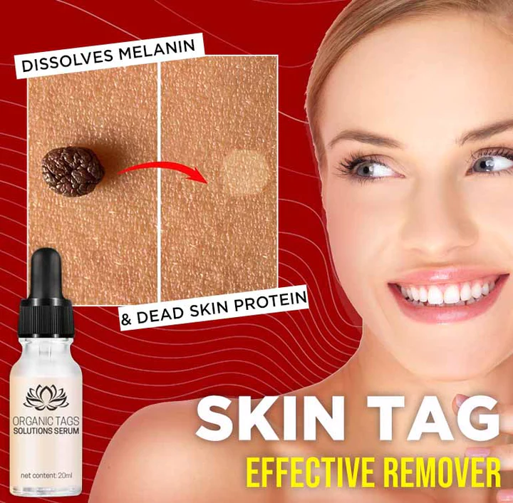TagGone Natural Tags Serum