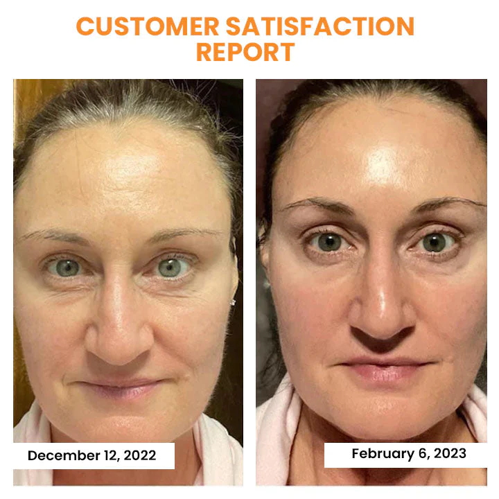 Oveallgo Korean NanoPro Dermalayr Technology Soluble Collagen Film