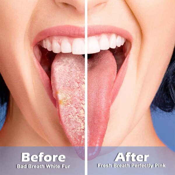Tongue Cleaning Gel