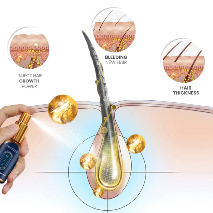 Oveallgo VENUSKISS Hair Stimulating Spray MAX