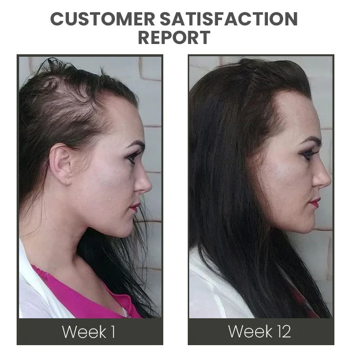 Oveallgo VENUSKISS Hair Stimulating Spray MAX