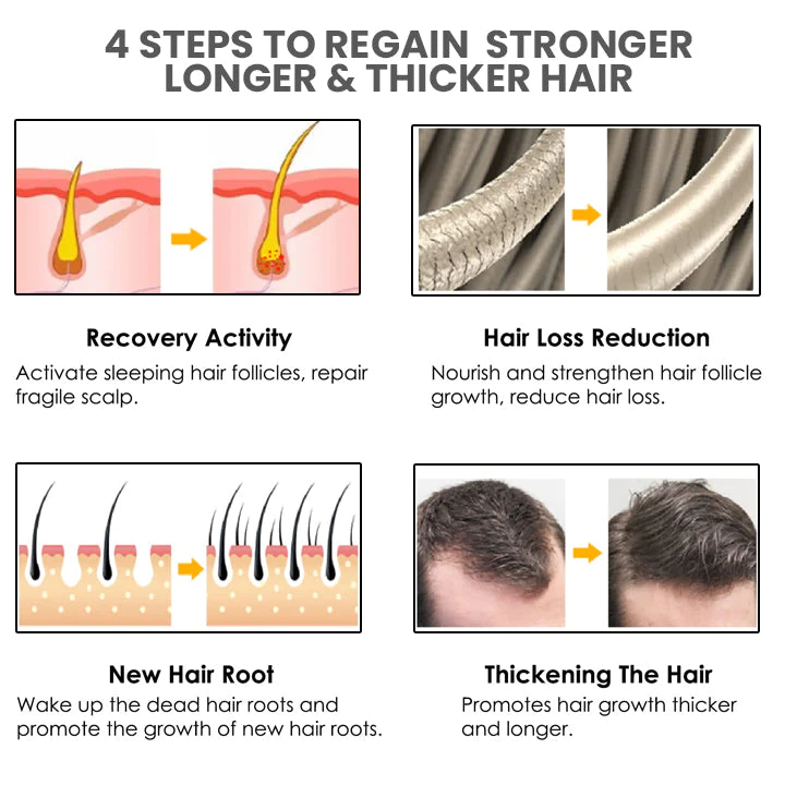 Oveallgo VENUSKISS Hair Stimulating Spray MAX