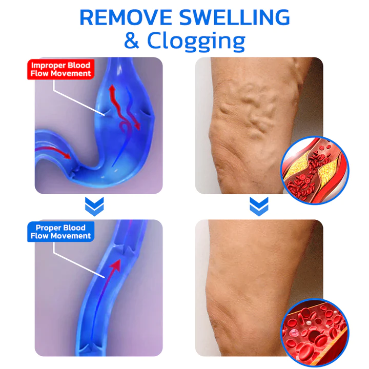 GFOUK Varicesness Treatment Patch