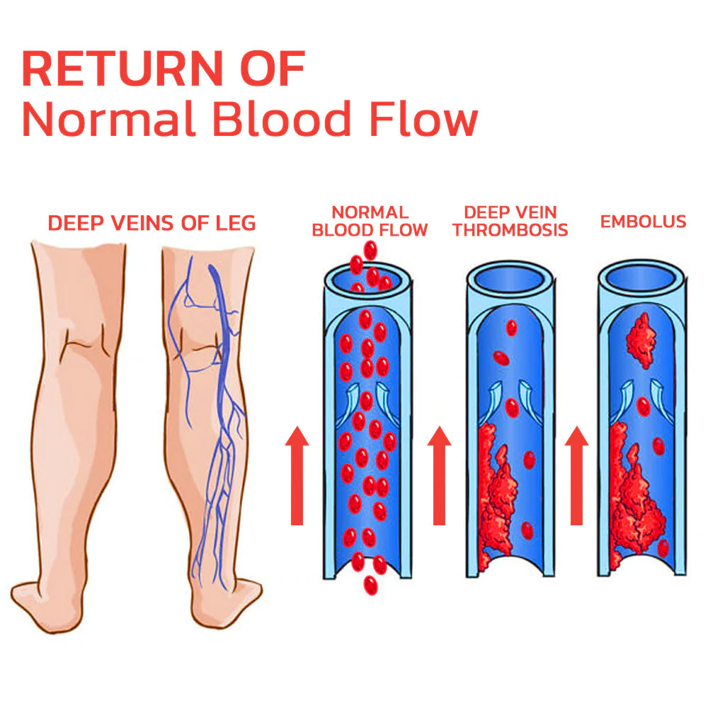Oveallgo VeinLess Immediate Relief Herbal Patch