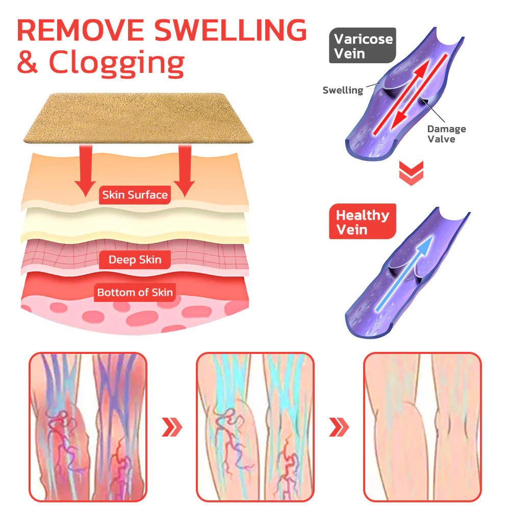 Oveallgo VeinLess Immediate Relief Herbal Patch