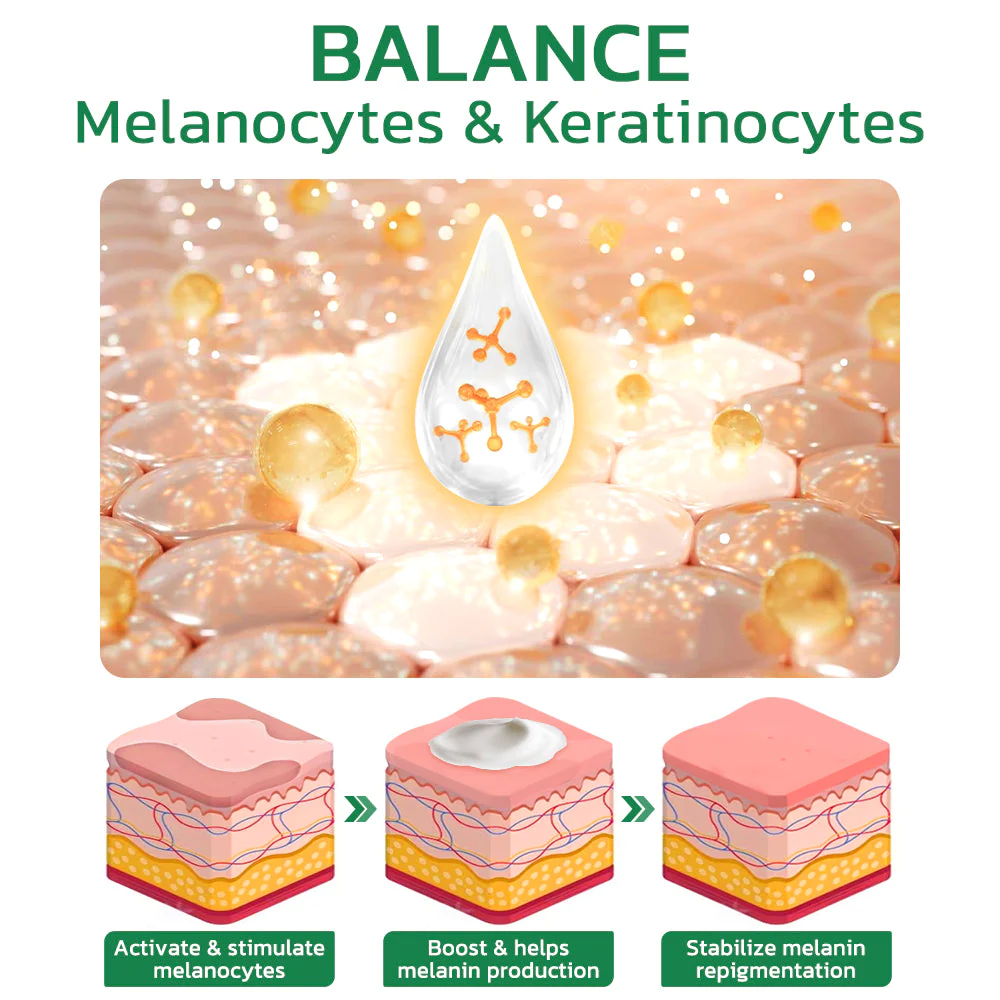 GFOUK TreatVitiligo Soothing Cream