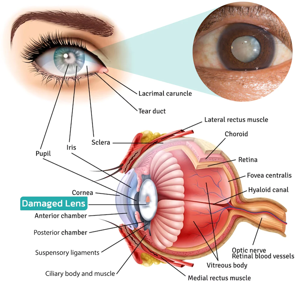 GFOUK OphthlaMed Vision Enhance Roller