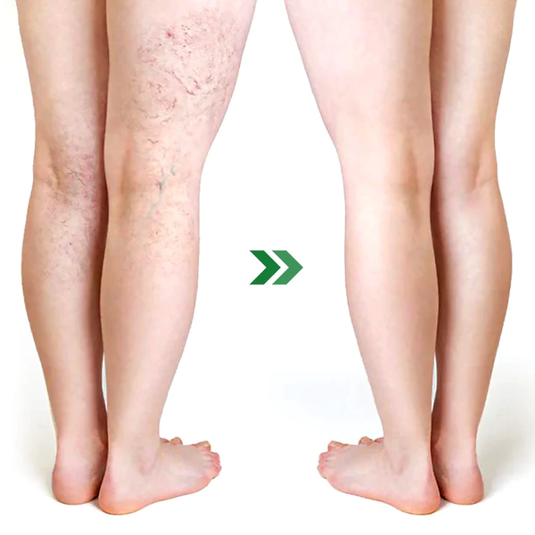 PureHealth Wormwood Body Detoxing Pads