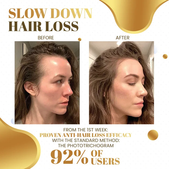 Orgadeco Biotin Hair Growth Roll-On Massage Essence