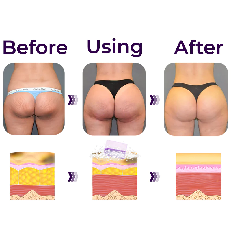 GFOUK Hip Lifting and Smoothing Brightening Soap