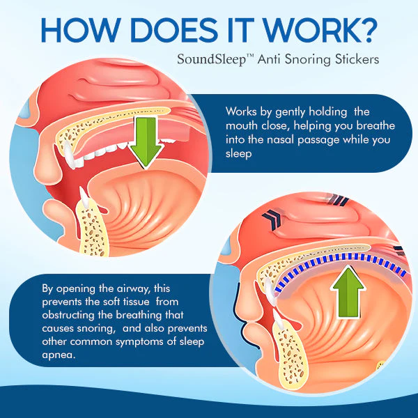SoundSleep Anti Snoring Stickers
