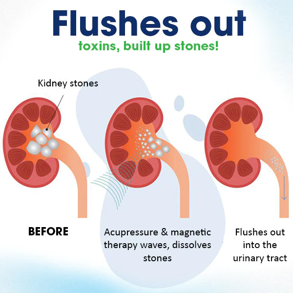 CC Acupressure Kidney Care Belt