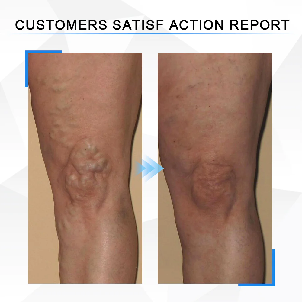 HapygoTourmaline Ionic Body Shaping Stretch Knee Brace