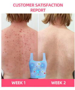 ANYIDEA Magnetic Nano Ion Fat Burning Belly Controlling Detoxifying Shaper