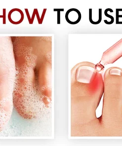 NailCare Ingrown Relief Oil