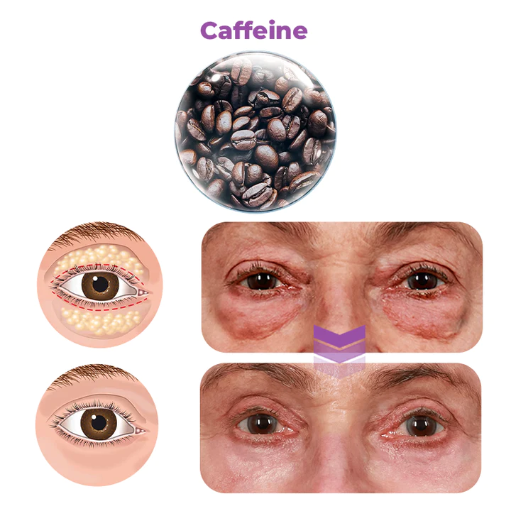 Oveallgo Milk Spots Therapy Electric Serum Pen