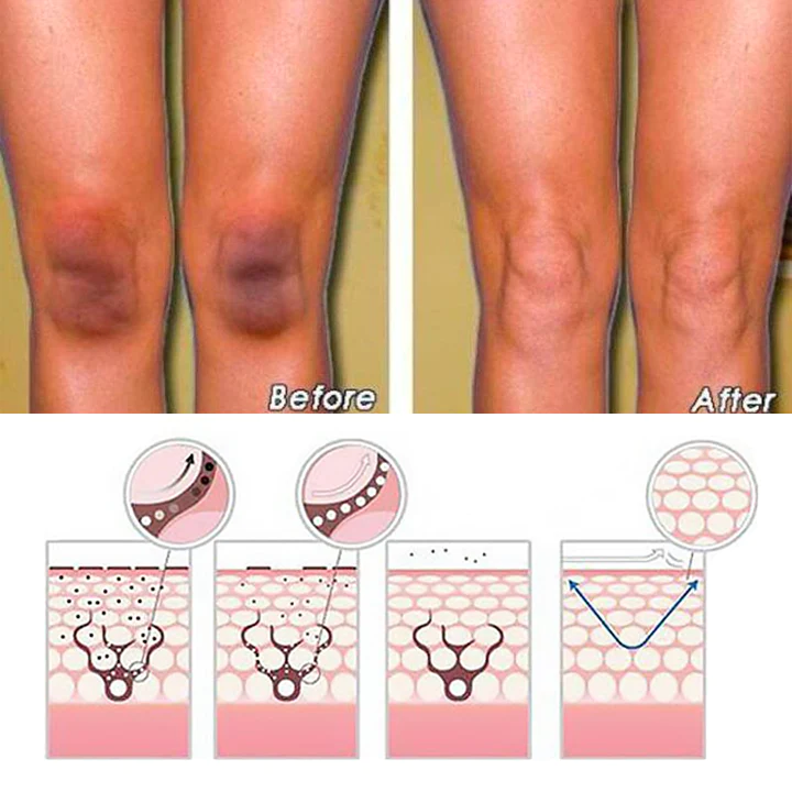 LUMIGLOW Dark Spot Correcting Cream