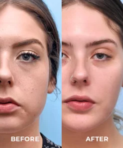 Clinical Retinol VC Wrinkle Serum