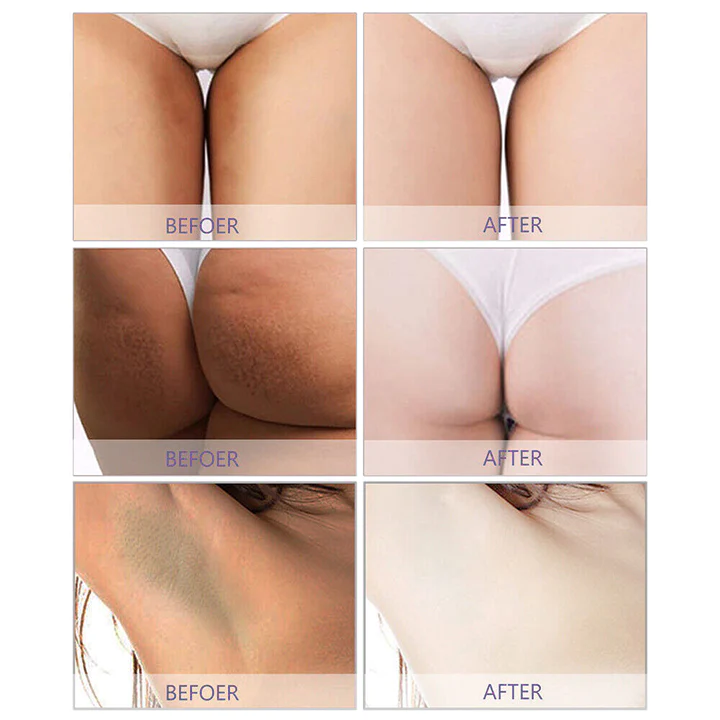 LUMIGLOW Dark Spot Correcting Cream