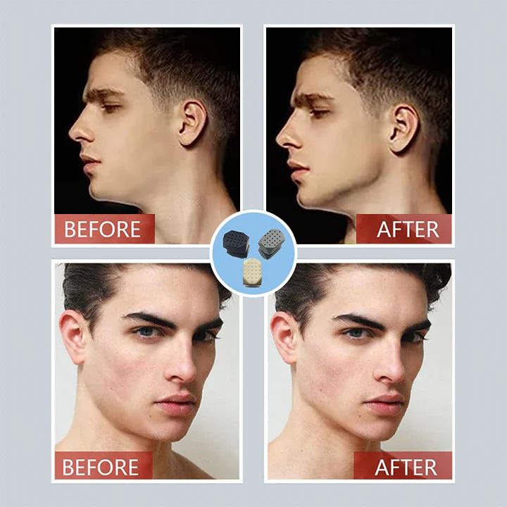 ShapeZ Jawline Exerciser
