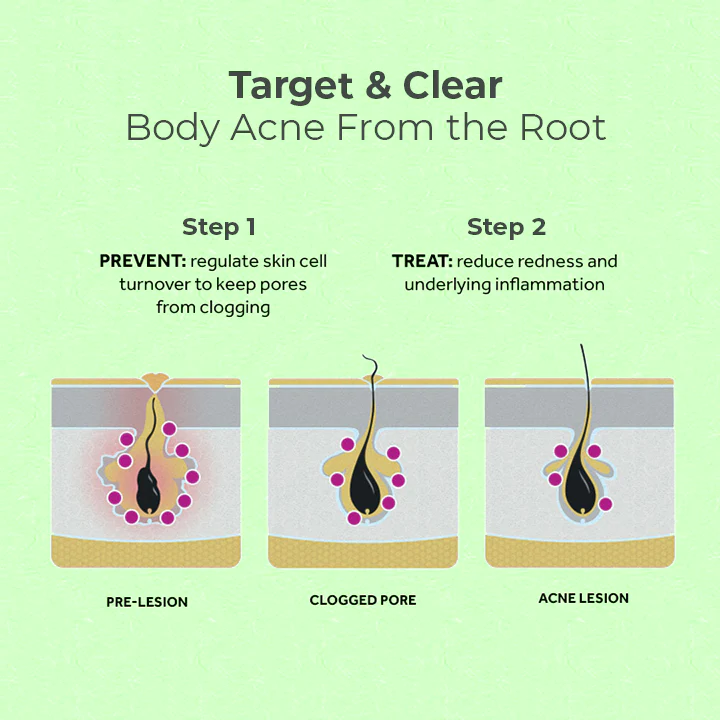 ClearSkin Bacne Treatment Spray