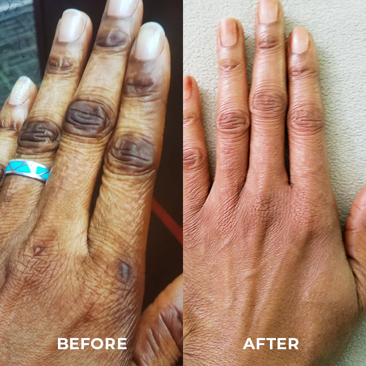 LUMIGLOW Dark Spot Correcting Cream