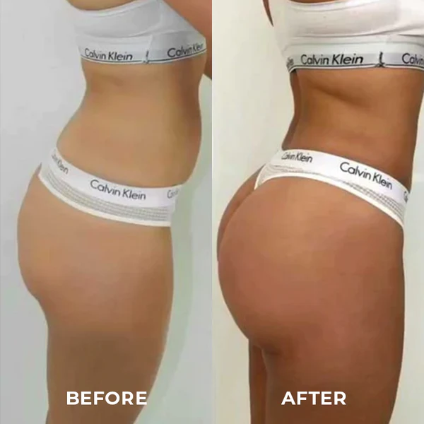 ShapeZ Buttock Lifting Instrument