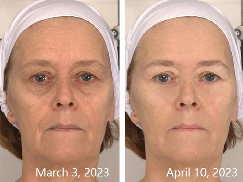 RenewalTouch Korean Collagen Firming Mask