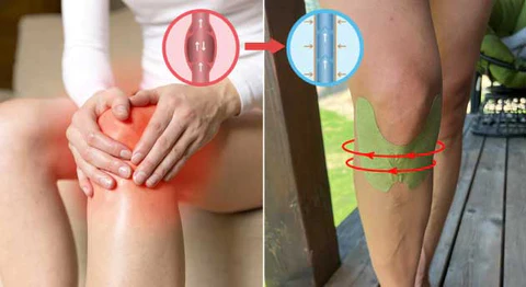 Sunmly Knee Pain Relief Patch