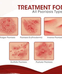 DermaCure Psoriasis Spray