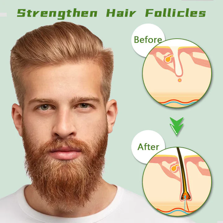 Biancat Red Ginseng Hair Regrowth Spray