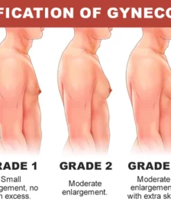 Oveallgo TurmericMax Gynecomastia Compress Patch