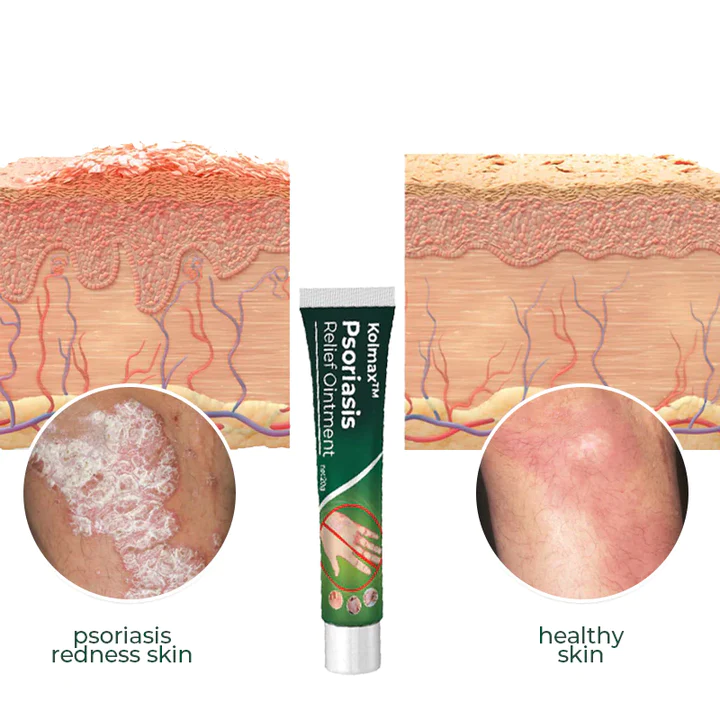 PUREX Psoriasis Soothing Ointment