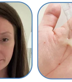 Fivfivgo Nasal Mucus Cleansing Spray