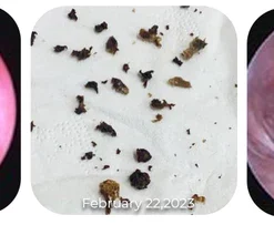 AntiCochlear Blockage Removal Spray