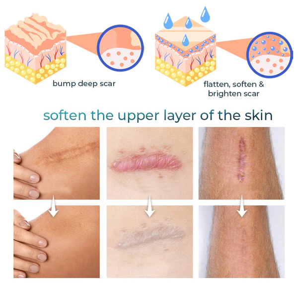 Bioskin Advanced Scar Removal Gel