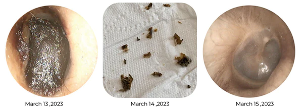 GFOUK Cochlear Care Oil